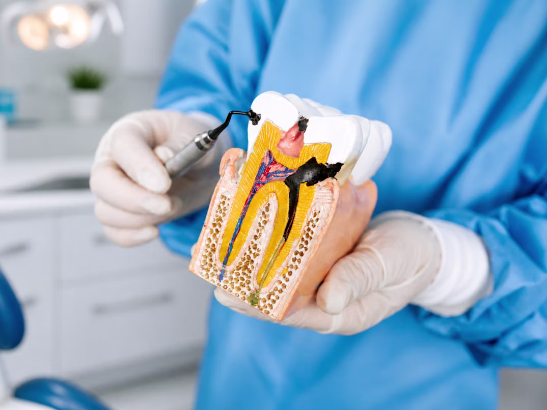 Profesional revisando los dientes en busca de caries