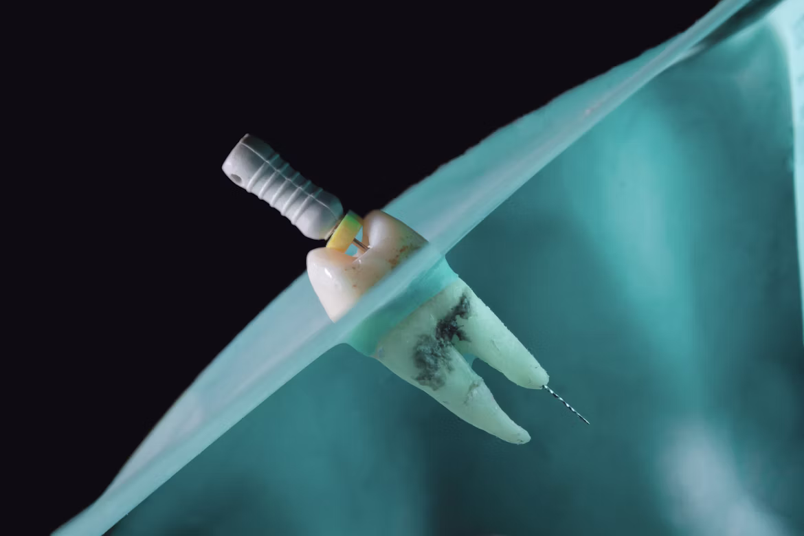 Radiografía dental usada para planificar un tratamiento de conducto