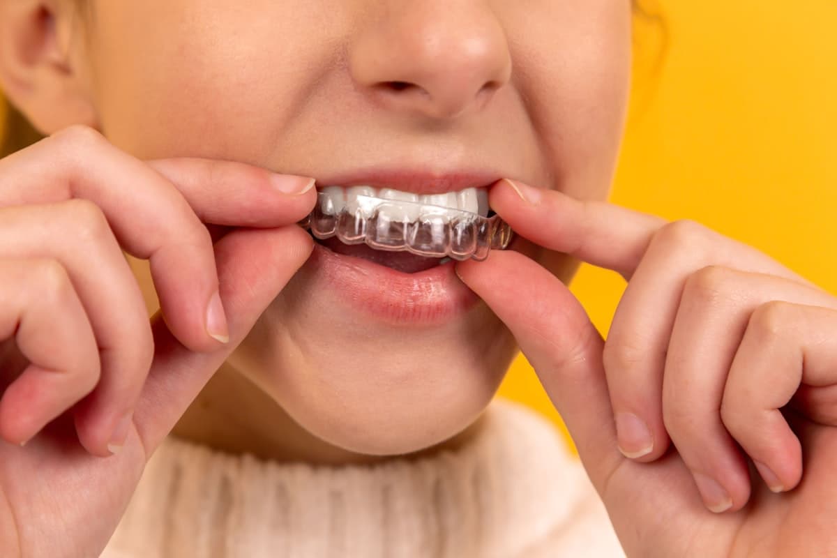 Detalle de ortodoncia con brackets en los dientes