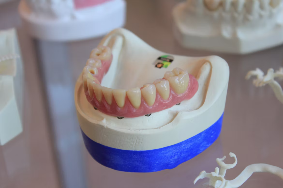 Prótesis dental sobre modelo en el consultorio odontológico